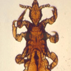 Pubic Lice